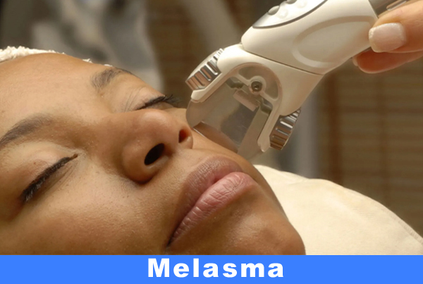 Hydrafacial